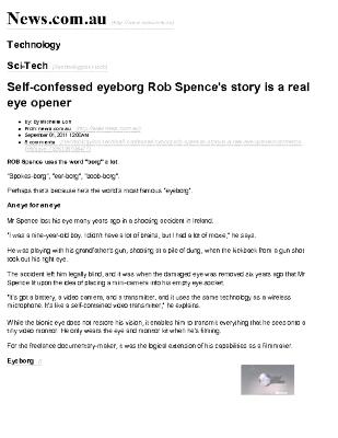 Self-Confessed Eyeborg Rob Spence's Story Is A Real Eye Opener