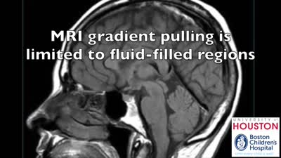 MRI-powered, Self-Assembled, Gauss Gun for Tissue Penetration