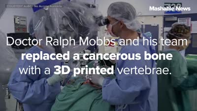 Surgeons Implant 3D-Printed Vertebrae to Save a Cancer Patient’s Life