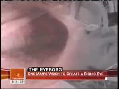 Eyeborg - Rob Spence on the Today Show