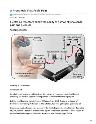 A Prosthetic That Feels Pain