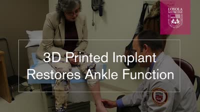 3D Printed Implant Restores Ankle Function