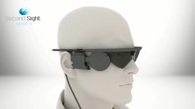 Second Sight Argus II Retinal Prosthesis System