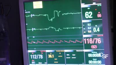 Google Glass Delivers New Insight During Surgery