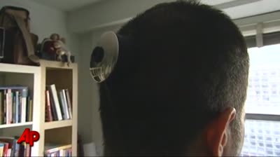 3rd Eye Artist Gets Camera Implanted in Head 